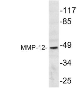 Western blot analysis of lysate from HepG2 cells using Anti-MMP-12 Antibody