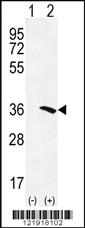 Anti-NAT2 Rabbit Polyclonal Antibody