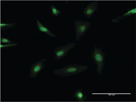 Anti-SRC Mouse Monoclonal Antibody [clone: 1B9]