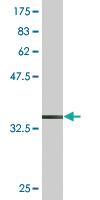 Anti-FLT3L Mouse Monoclonal Antibody [clone: 4C4]