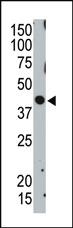 Anti-TSG101 Rabbit Polyclonal Antibody