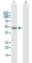 Anti-MAGEA8 Rabbit Polyclonal Antibody