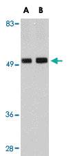 Anti-TMEM214 Rabbit Polyclonal Antibody