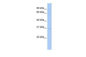 Anti-STK16 Rabbit Polyclonal Antibody