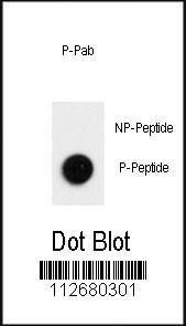 Anti-LC3B Rabbit Polyclonal Antibody (AP (Alkaline Phosphatase))