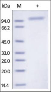 The purity of rhCDH6 /Cadherin-6 was determined by reduced SDS-PAGE and staining overnight with Coomassie Blue.