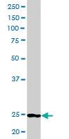 Anti-BCL2 Goat Polyclonal Antibody