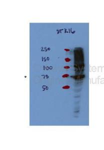 Anti-STK16 Rabbit Polyclonal Antibody