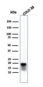 Anti-MelanA Rabbit Recombinant Antibody [clone: MLANA/4385R]