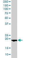 Anti-BIRC5 Goat Polyclonal Antibody