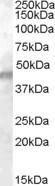 Anti-Kcnj11 Antibody (A84342) (0.01µg/ml) staining of Human Muscle lysate (35µg protein in RIPA buffer). Primary incubation was 1 hour. Detected by chemiluminescence.