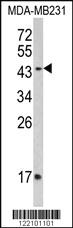 Anti-IFNGR2 Rabbit Polyclonal Antibody