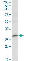 Anti-MAGEA8 Rabbit Polyclonal Antibody