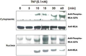 Anti-RELA Rabbit Polyclonal Antibody