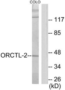 Western blot analysis of lysates from COLO205 cells using Anti-ORCTL-2 Antibody. The right hand lane represents a negative control, where the antibody is blocked by the immunising peptide.