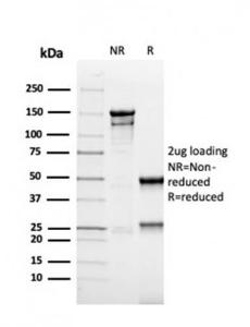 SDS-PAGE analysis of Anti-MSH6 Antibody [rMSH6/4743] under non-reduced and reduced conditions; showing intact IgG and intact heavy and light chains, respectively. SDS-PAGE analysis confirms the integrity and purity of the antibody