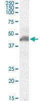 Anti-ACTA2 Goat Polyclonal Antibody