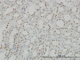 Anti-CDKL1 Mouse Monoclonal Antibody [clone: 5B11]