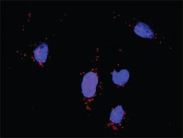 Anti-MAPKAPK5 + MAPK9 Antibody Pair