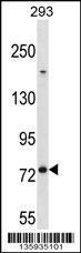 Anti-MED16 Rabbit Polyclonal Antibody (HRP (Horseradish Peroxidase))