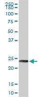 Anti-MAGEA8 Rabbit Polyclonal Antibody