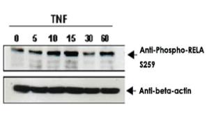 Anti-RELA Rabbit Polyclonal Antibody