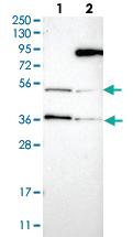 Anti-LARP7 Rabbit Polyclonal Antibody