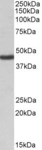 EB09130 (1 µg/ml) staining of Human Kidney lysate (35 µg protein in RIPA buffer). Primary incubation was 1 hour. Detected by chemiluminescence.