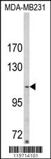 Anti-CNNM4 Rabbit Polyclonal Antibody