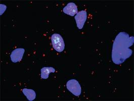 Anti-CASP3 + MDM2 Antibody Pair