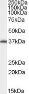 Anti-AIP Antibody (A84344) (0.02 µg/ml) staining of NIH/3T3 cell lysate (35 µg protein in RIPA buffer). Primary incubation was 1 hour. Detected by chemiluminescence