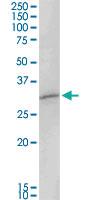 Anti-MAGEA8 Rabbit Polyclonal Antibody