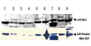 Anti-RELA Rabbit Polyclonal Antibody