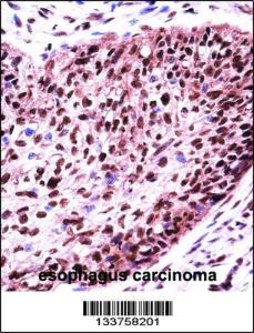 Anti-SF3B1 Rabbit Polyclonal Antibody (FITC (Fluorescein Isothiocyanate))