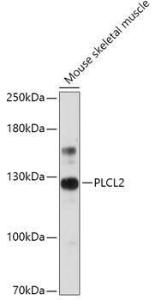 Anti-PLCL2 antibody