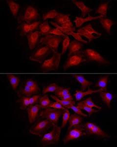 Immunofluorescence analysis of HeLa cells using Anti-NF-kB p65 Antibody (A309933) at a dilution of 1:100 (40x lens). DAPI was used to stain the cell nuclei (blue).