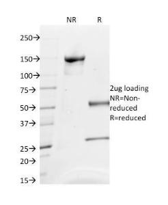 SDS-PAGE analysis of Anti-CD63 Antibody [NKI/C3] under non-reduced and reduced conditions; showing intact IgG and intact heavy and light chains, respectively. SDS-PAGE analysis confirms the integrity and purity of the antibody