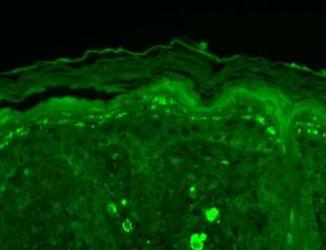 Immunohistochemistry analysis of mouse backskin, fixed in Bouin's fixative solution and paraffin-embedded The Primary Antibody used was Anti-SHANK3 Antibody [S69] (A304813) at 1:100 for 1 hour at room temperature