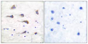 Immunohistochemical analysis of paraffin-embedded human brain tissue using Anti-mGluR6 Antibody. The right hand panel represents a negative control, where the Antibody was pre-incubated with the immunising peptide