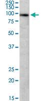 Anti-DTX3 Goat Polyclonal Antibody