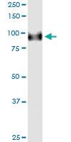 Anti-FBXO42 Polyclonal Antibody Pair