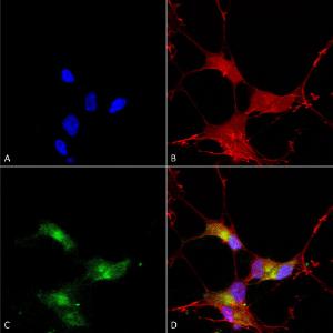 Immunocytochemistry/Immunofluorescence analysis of human neuroblastoma cells (SH-SY5Y), fixed in 4% PFA for 15 min, using Anti-SHANK3 Antibody [S69] (A304813), at 1:50 for overnight at 4°C with slow rocking