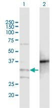 Anti-MOGAT2 Mouse Polyclonal Antibody