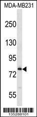 Anti-MED17 Rabbit Polyclonal Antibody (Biotin)