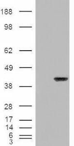 HEK293 overexpressing ARA9 (RC211157) and probed with Anti-AIP Antibody (A84344) (mock transfection in first lane), tested by Origene