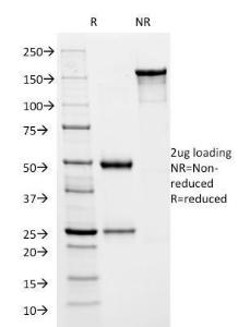 SDS-PAGE analysis of Anti-HSV1 ICP8 Antibody [HSVI/2045] under non-reduced and reduced conditions; showing intact IgG and intact heavy and light chains, respectively SDS-PAGE analysis confirms the integrity and purity of the antibody