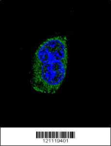 Anti-TSHB Rabbit Polyclonal Antibody (Biotin)