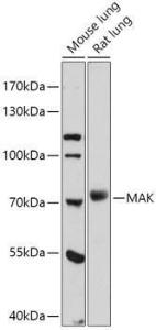 Western blot analysis of extracts of various cell lines, using Anti-MAK Antibody (A308925) at 1:1,000 dilution. The secondary antibody was Goat Anti-Rabbit IgG H&L Antibody (HRP) at 1:10,000 dilution.