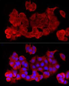 Immunofluorescence analysis of MCF7 cells using Anti-NF-kB p65 Antibody (A309933) at a dilution of 1:100 (40x lens). DAPI was used to stain the cell nuclei (blue).