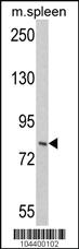 Anti-HGS Rabbit Polyclonal Antibody